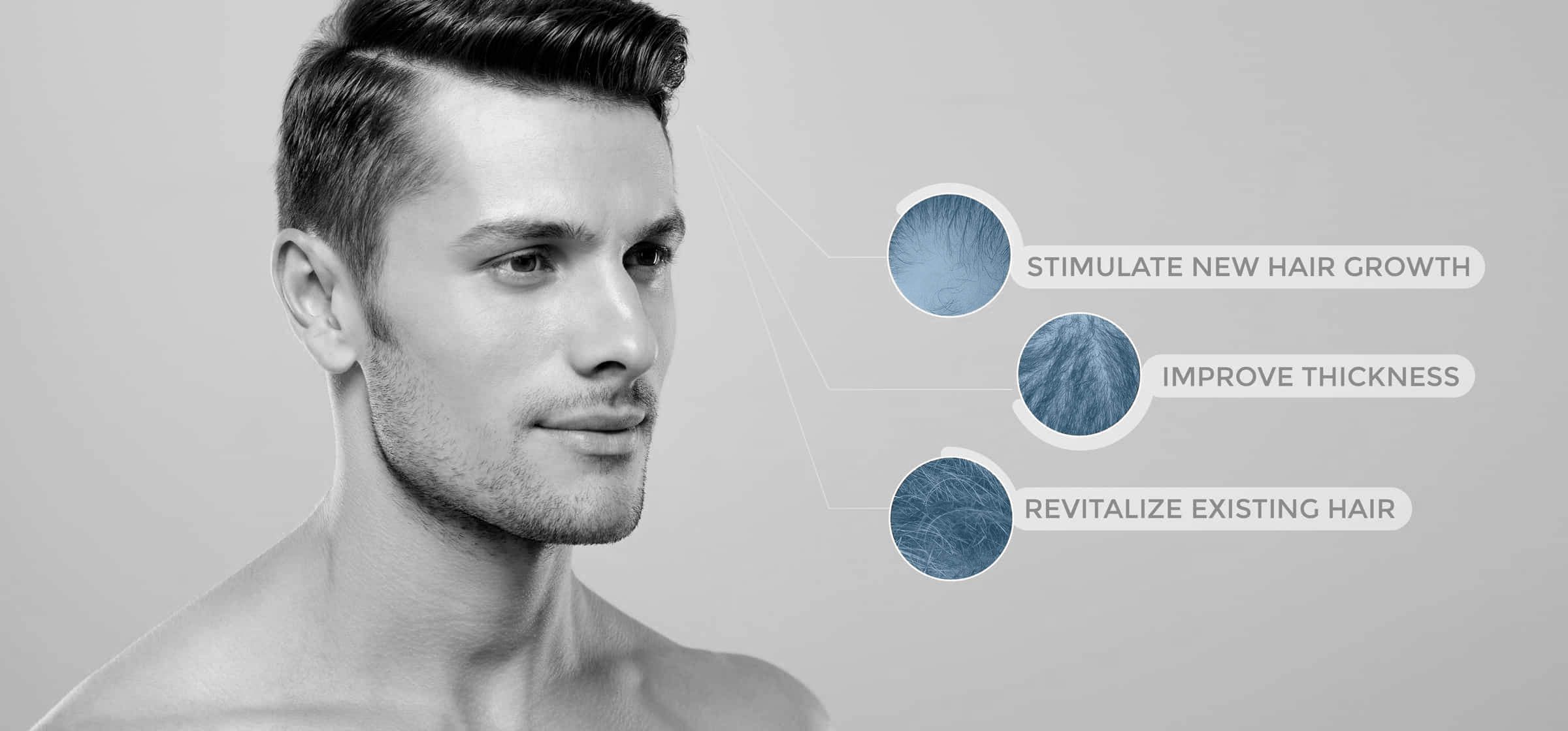 Hair Loss Treatment for Men | Elna Esthetics Medispa | Non-surgical facial  rejuvenation in Montreal