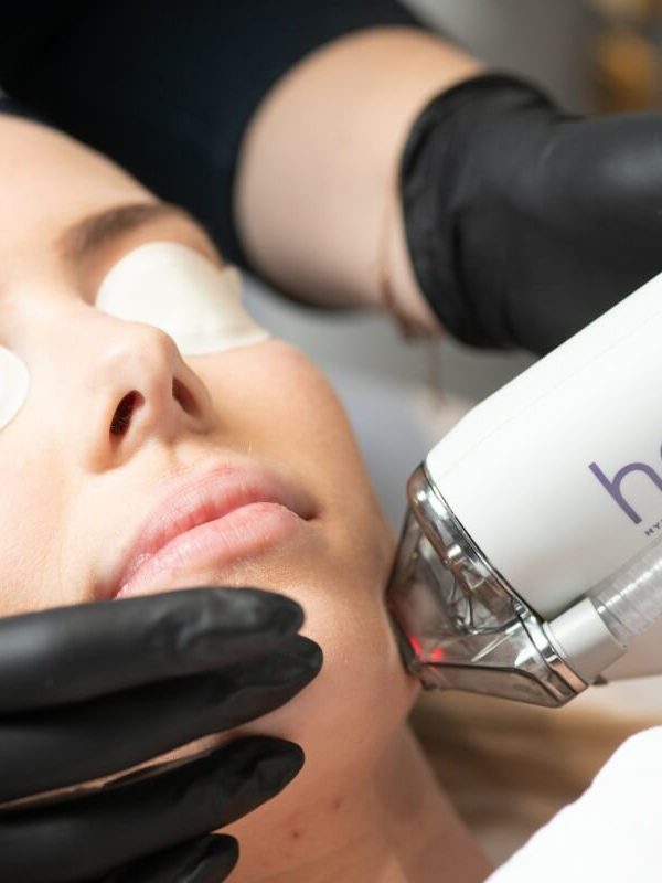 Halo Laser / Laser Skin Resurfacing procedure on woman's face
