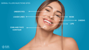 dermal fillers injections areas