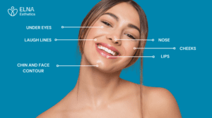 dermal fillers most common areas 